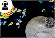 Dr. Niculina Musat webinar